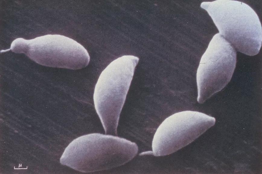 En los tejidos infectados por el Toxoplasma gondii se forman pseudoquistes