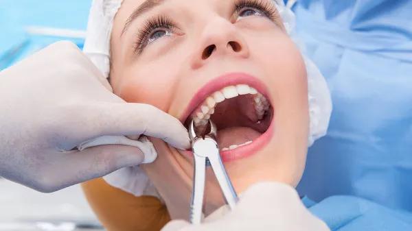 CBD en dosis alta muestra señal de alivio tras extracciones dentales