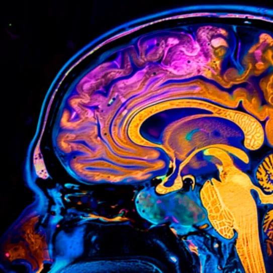 ¿Puede la ketamina dejar una huella en un cerebro bajo anestesia?