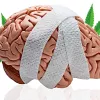 El THC contra el daño cerebral, ¿cómo puede ayudar?