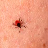 Psilocibina para enfrentar los efectos persistentes de la enfermedad de Lyme