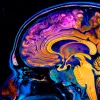 ¿Puede la ketamina dejar una huella en un cerebro bajo anestesia?
