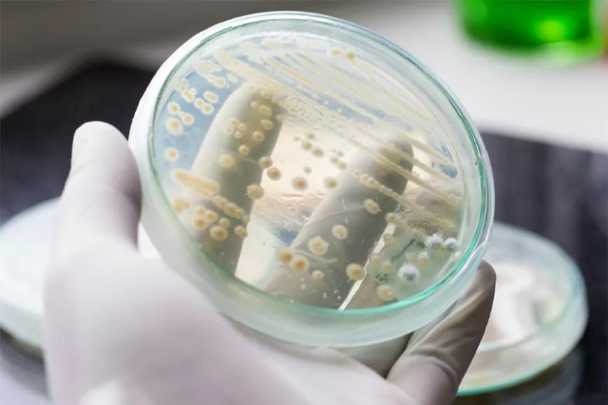Los hongos de la levadura como la respuesta para crear nuevos cannabinoides