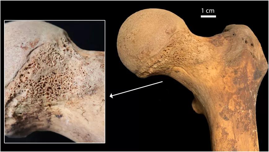 Italia: arqueólogos encuentran rastros de cannabis en huesos humanos del siglo XVII