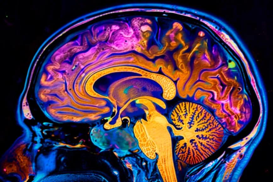 ¿Puede la ketamina dejar una huella en un cerebro bajo anestesia?