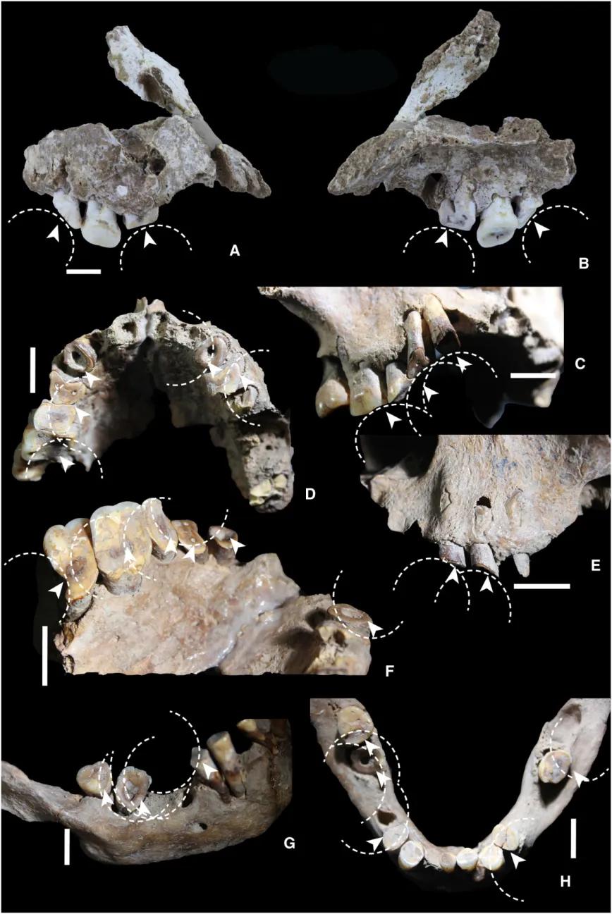 Desgaste dental relacionado con el consumo de drogas en los primeros cazadores-recolectores de Sulawesi.
